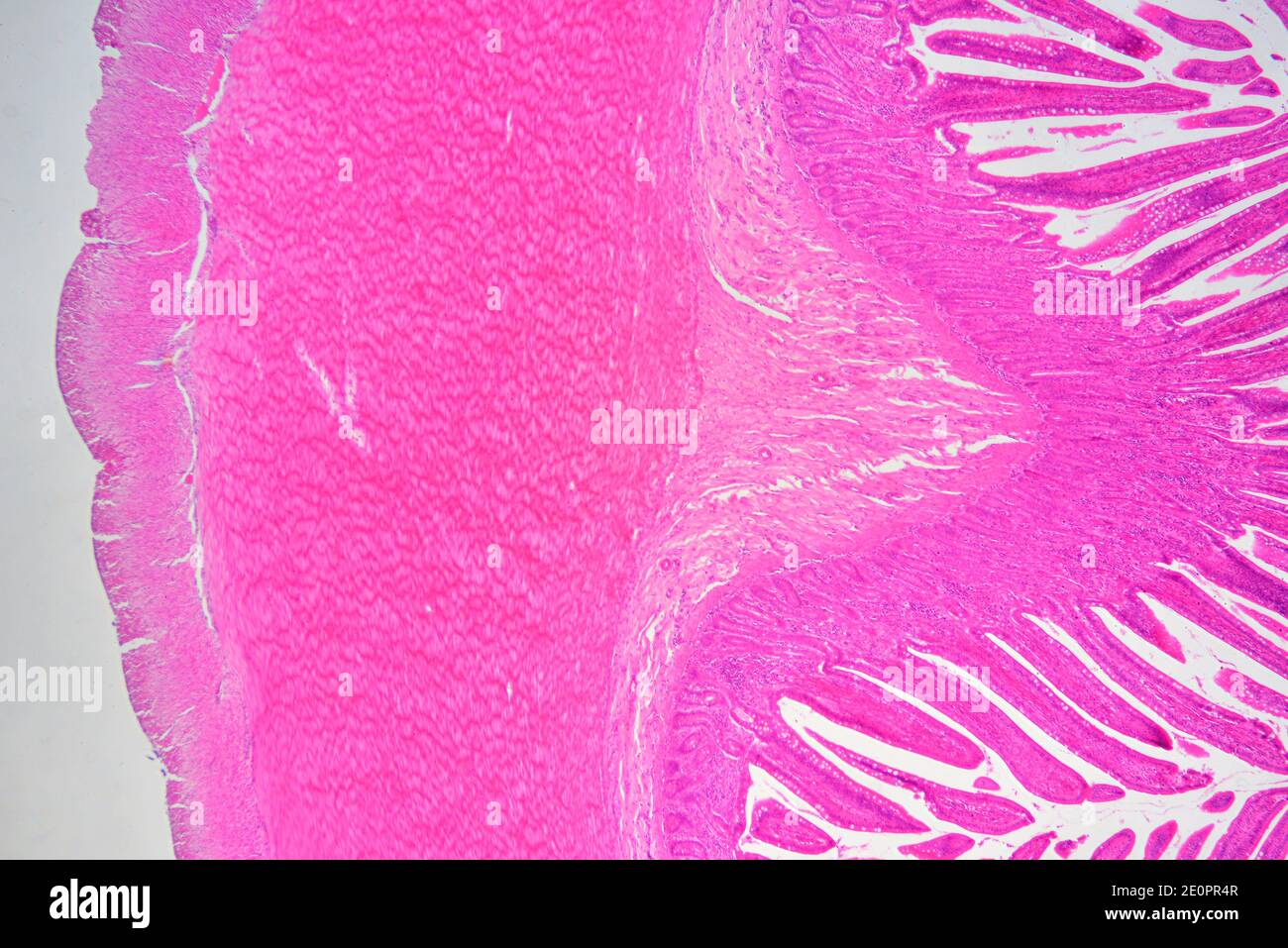 Intestino tenue umano da sinistra a destra: Serosa, fibre muscolari longitudinali e circolari, sottomucosa e mucosa con cripte di Lieberkhun. X25 Foto Stock