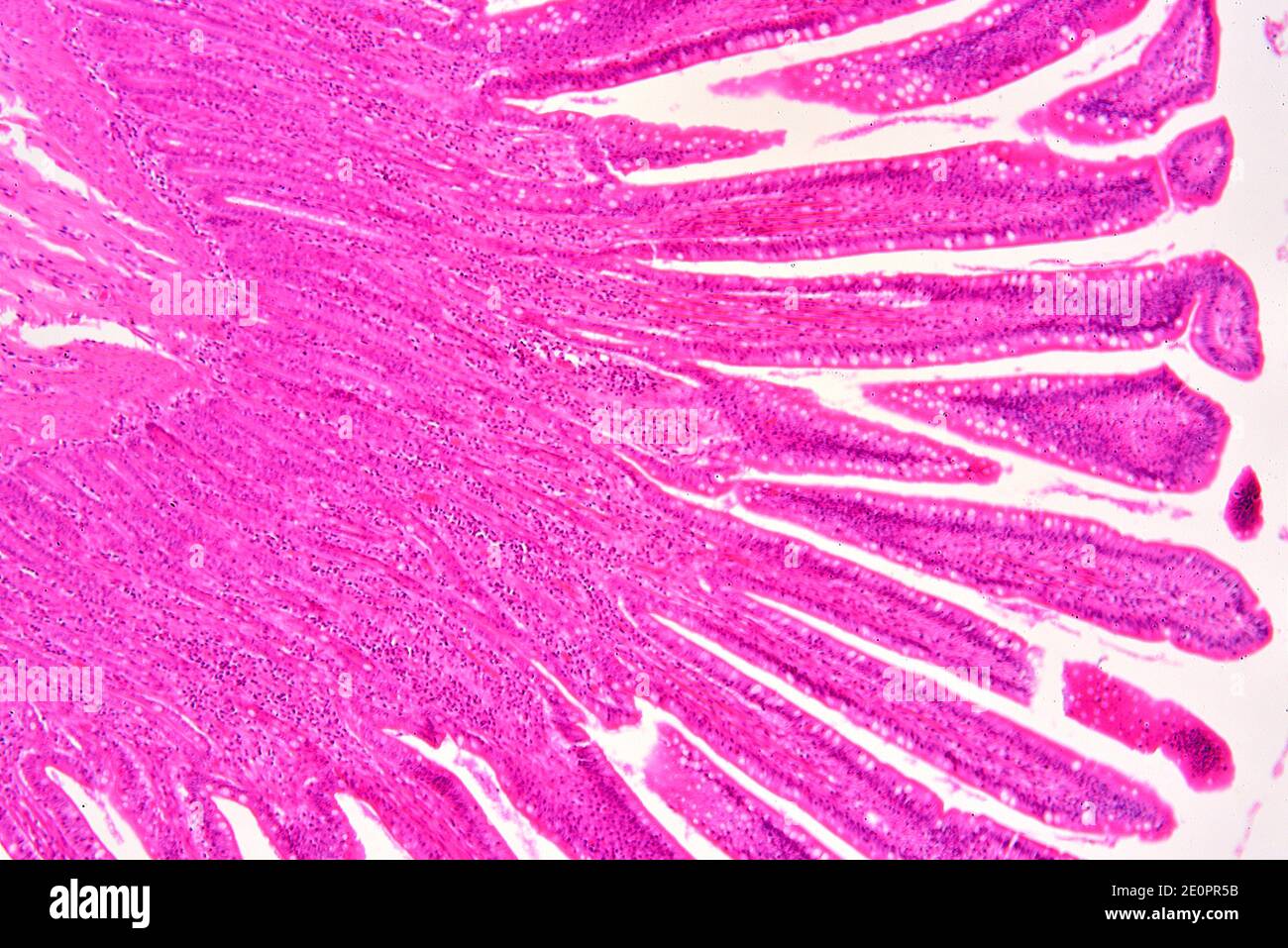 Intestino tenue umano che mostra mucosa con le cripte di Lieberkhun. X75 a 10 cm di larghezza. Foto Stock