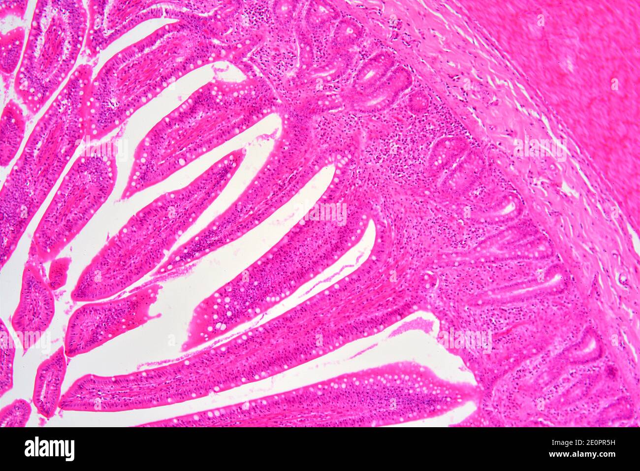 Intestino tenue umano che mostra mucosa con le cripte di Lieberkhun. X75 a 10 cm di larghezza. Foto Stock