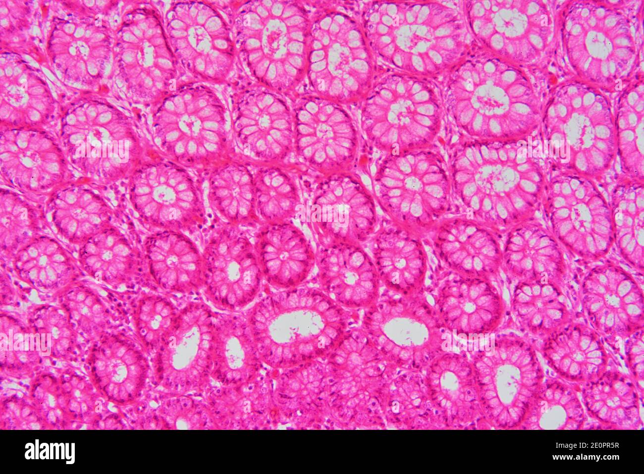 Intestino crasso umano (colon) che mostra mucosa con le cripte di Lieberkhun. X125 a 10 cm di larghezza. Foto Stock