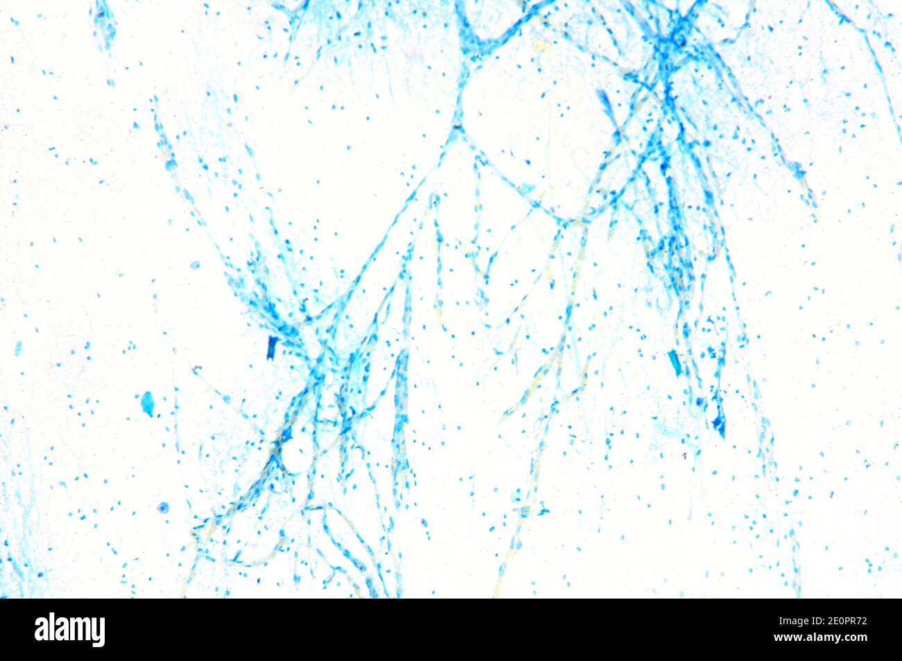 Neuroni motori umani (terminazioni). X75 a 10 cm di larghezza. Foto Stock