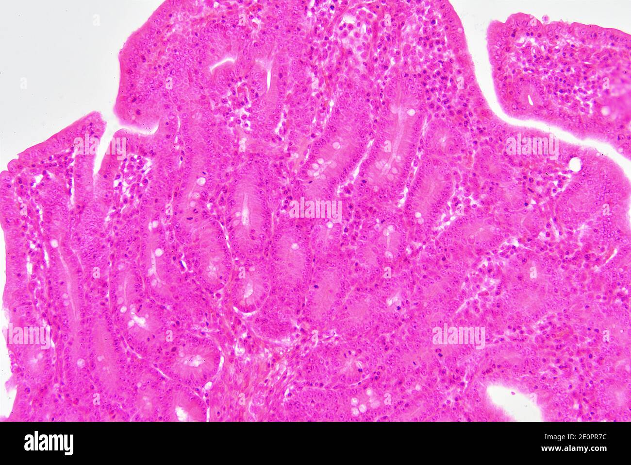 Intestino tenue umano (jejunum) che mostra mucosa con le cripte di Lieberkhun. X125 a 10 cm di larghezza. Foto Stock