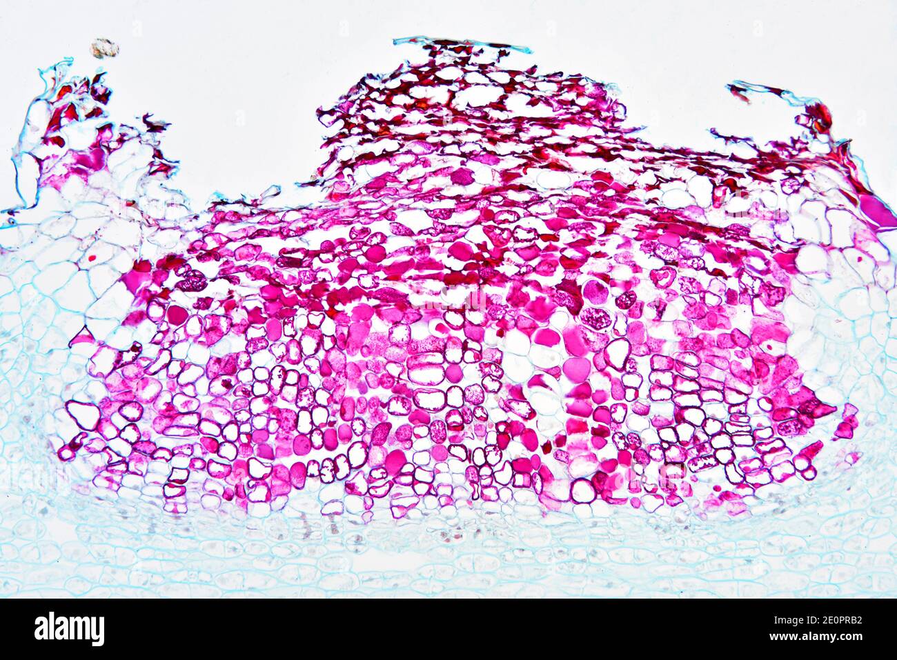 Lenticel è un tessuto poroso trovato in piante di corteccia la cui funzione è di scambiare gas. Fotomicrografo X50 con larghezza di 10 cm. Foto Stock