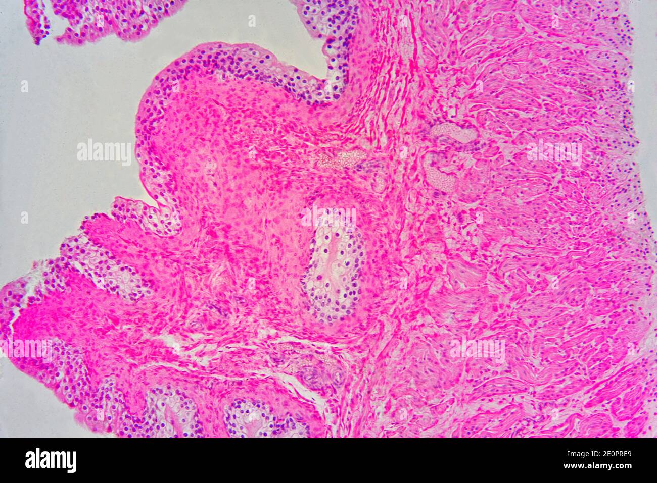 Vescica urinaria con urotelio (epitelio transitorio), tessuto connettivo e fibre muscolari lisce. Fotomicrografo X75 con larghezza di 10 cm. Foto Stock