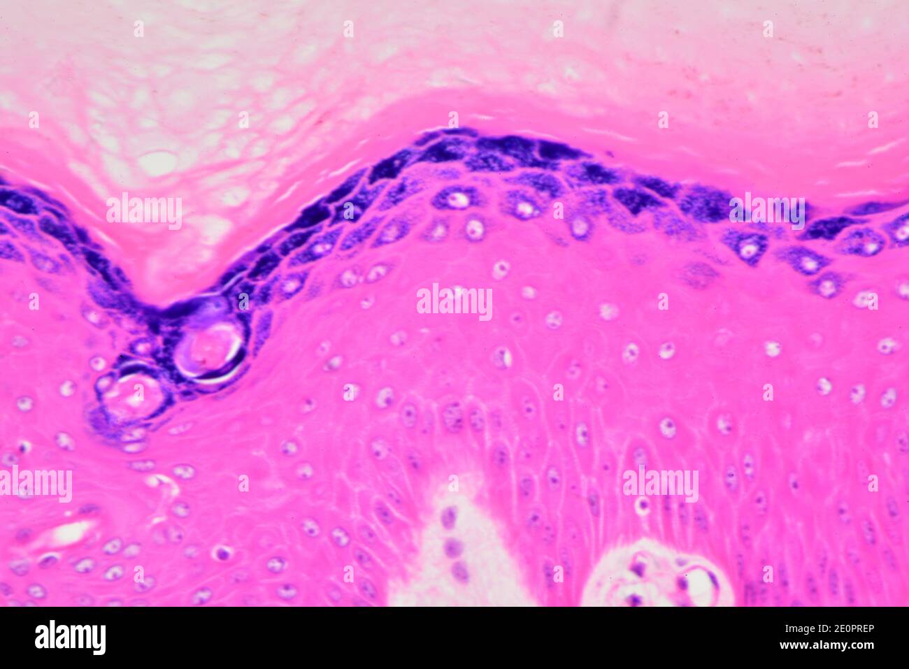 Pelle umana che mostra epidermide fino a giù (epitelio cheratinizzato squamoso) strato corneo, strato di pigmento e strato germinativum. Foto Stock