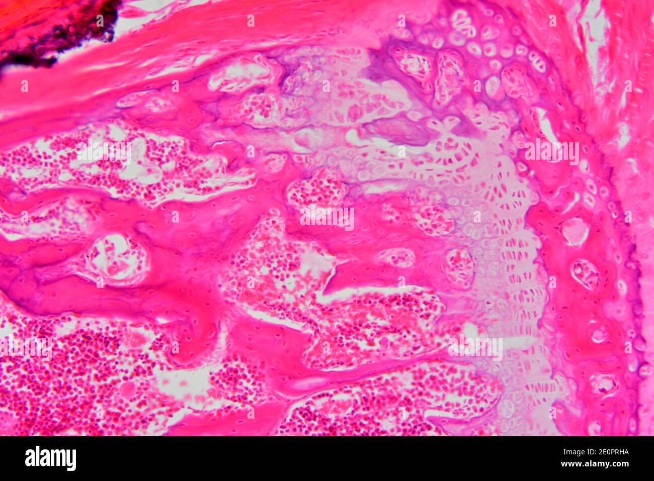 Midollo Osseo Immagini e Fotos Stock Alamy