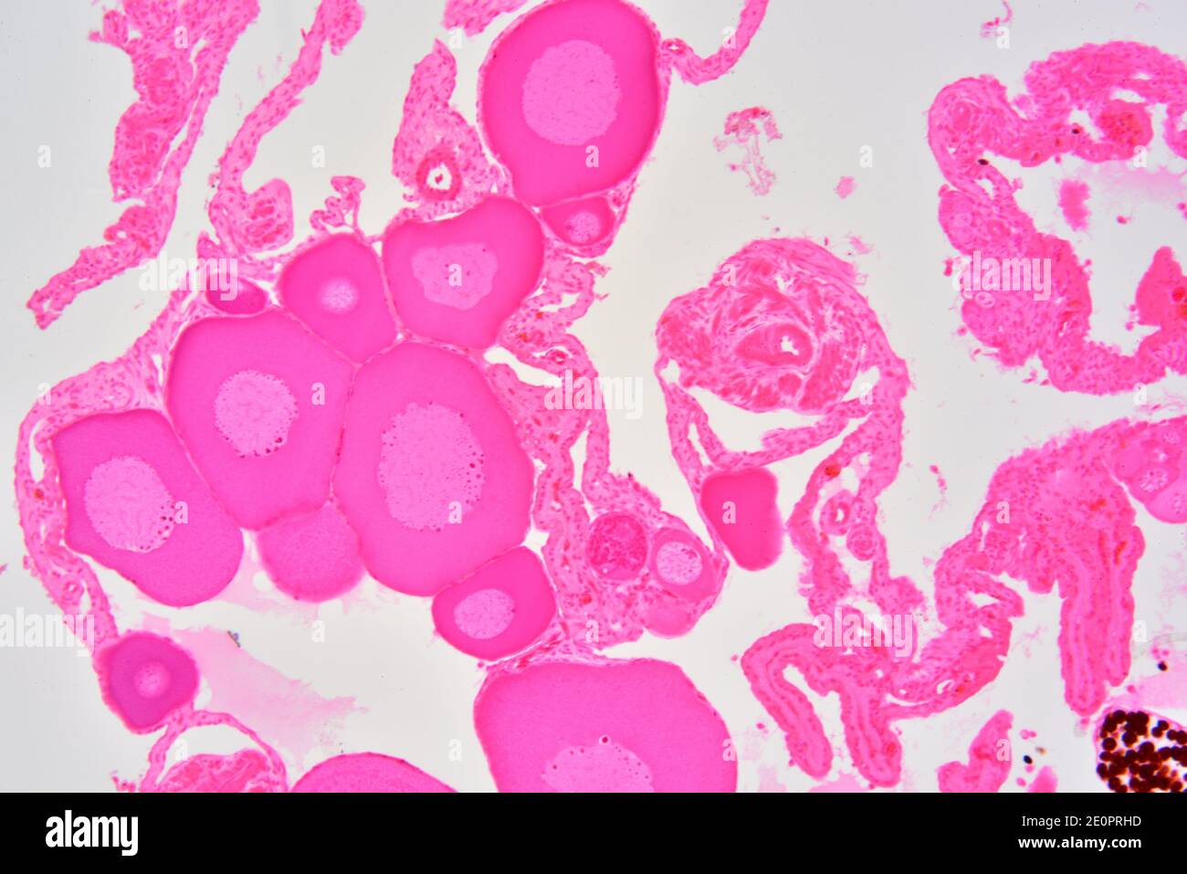 Ovaia di rana che mostra oogonie, oociti immaturi, oociti maturi, vescicole germinali e nucleoli. Fotomicrografo X75 con larghezza di 10 cm. Foto Stock