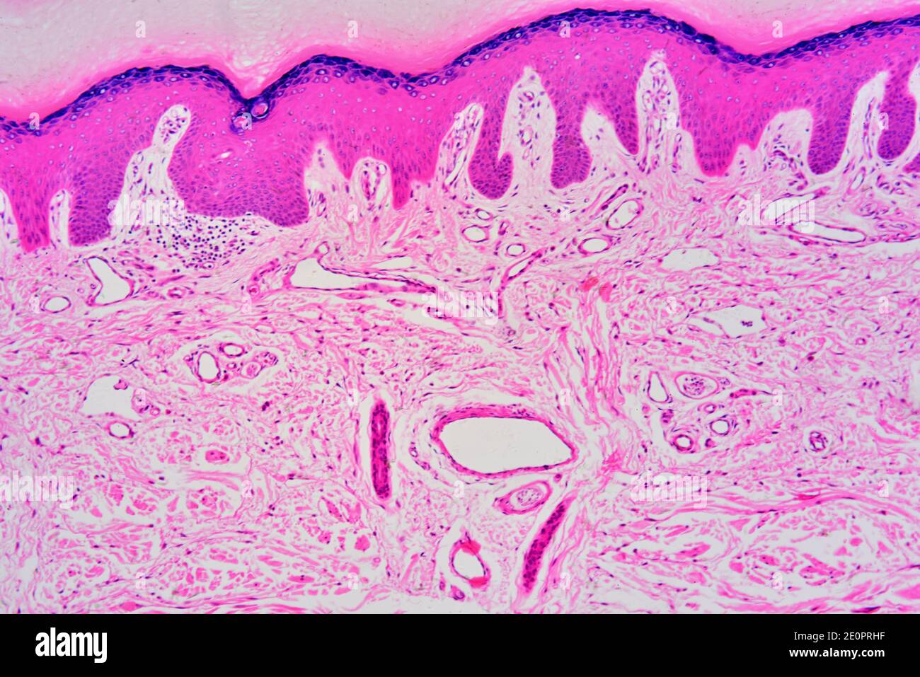 Pelle umana che mostra da su a giù: Epidermide (epitelio cheratinizzato  squamoso) e derma con papilla dermica, vasi sanguigni, tessuto connettivo e  Foto stock - Alamy