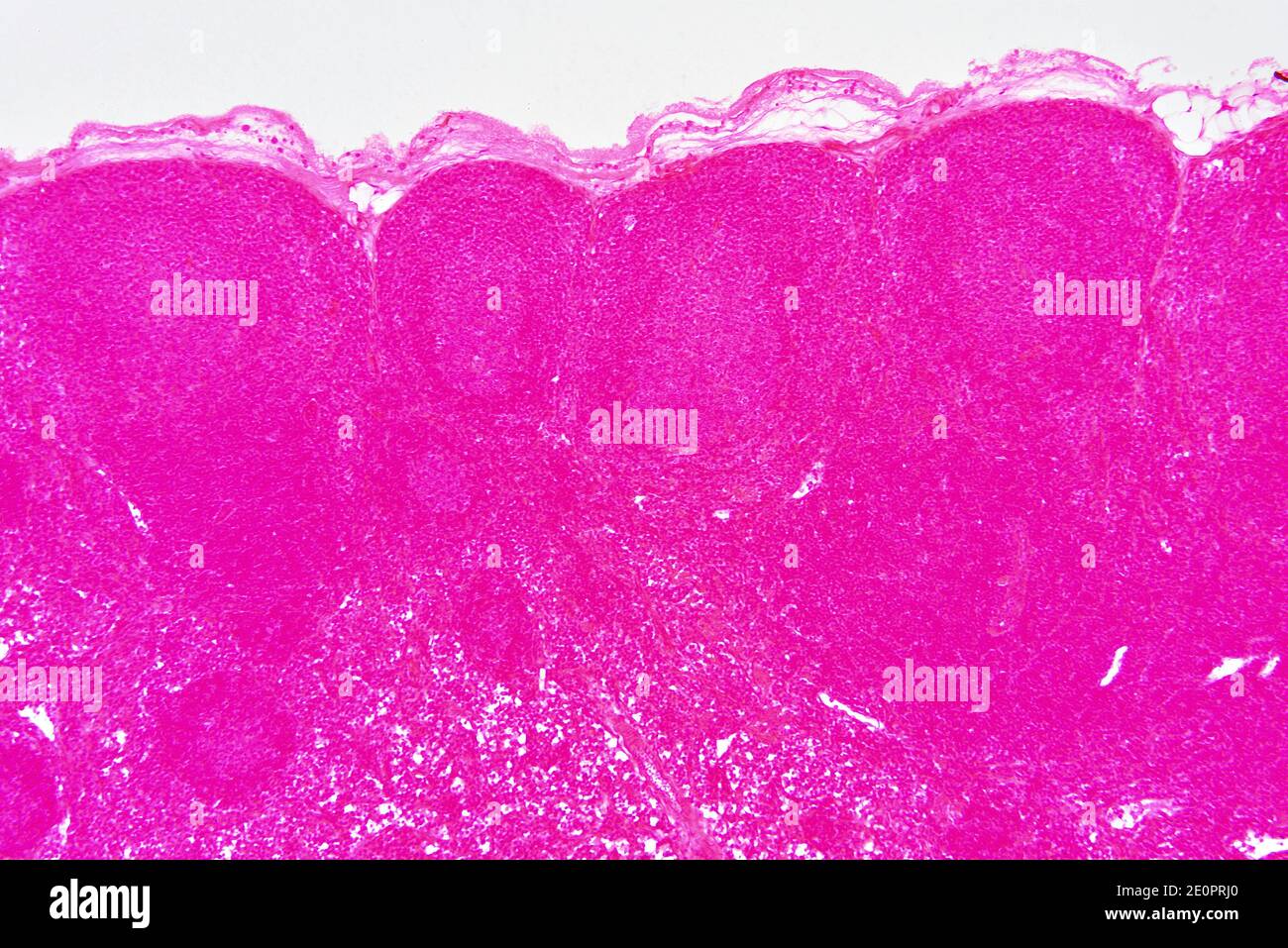 Linfonodo o ghiandola linfonodale con capsula, nodulo linfoide e trabecole. Fotomicrografo X75 con larghezza di 10 cm. Foto Stock