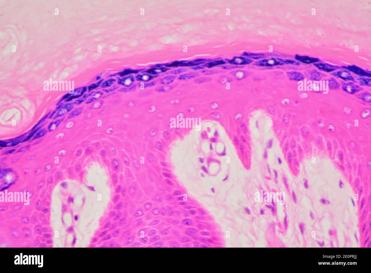 Pelle umana che mostra epidermide fino a giù (epitelio cheratinizzato squamoso) strato corneo, strato di pigmento e strato germinativum. Foto Stock