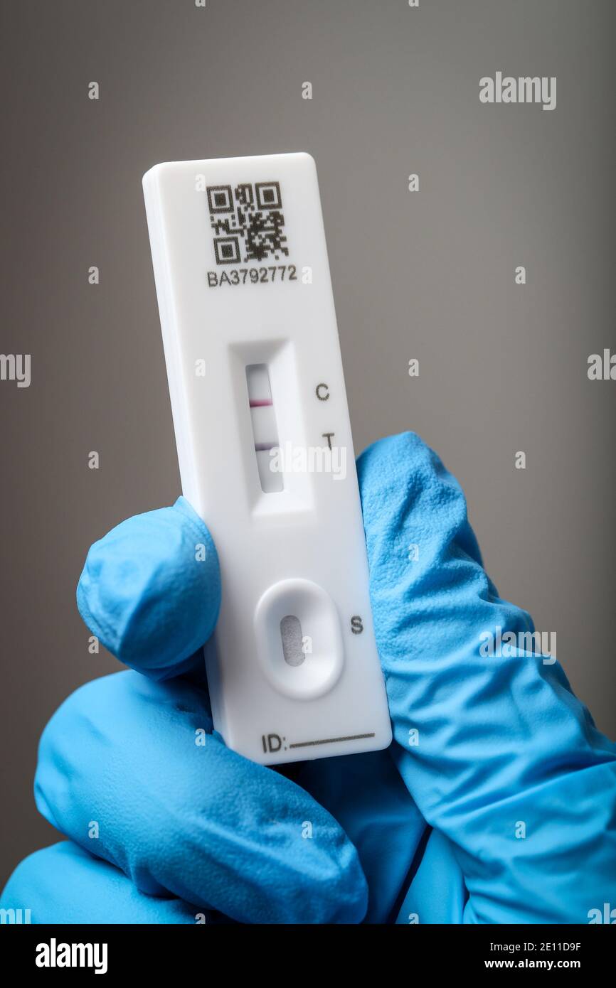 Test del coronavirus utilizzando un dispositivo a flusso laterale, il test mostra un risultato positivo, il paziente ha un coronavirus. Foto Stock