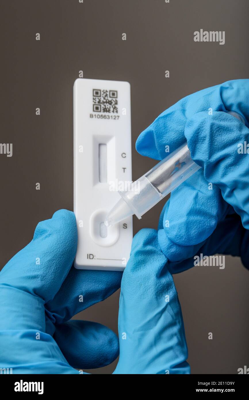 Test del coronavirus con un kit di test del dispositivo Lateral Flow. Foto Stock