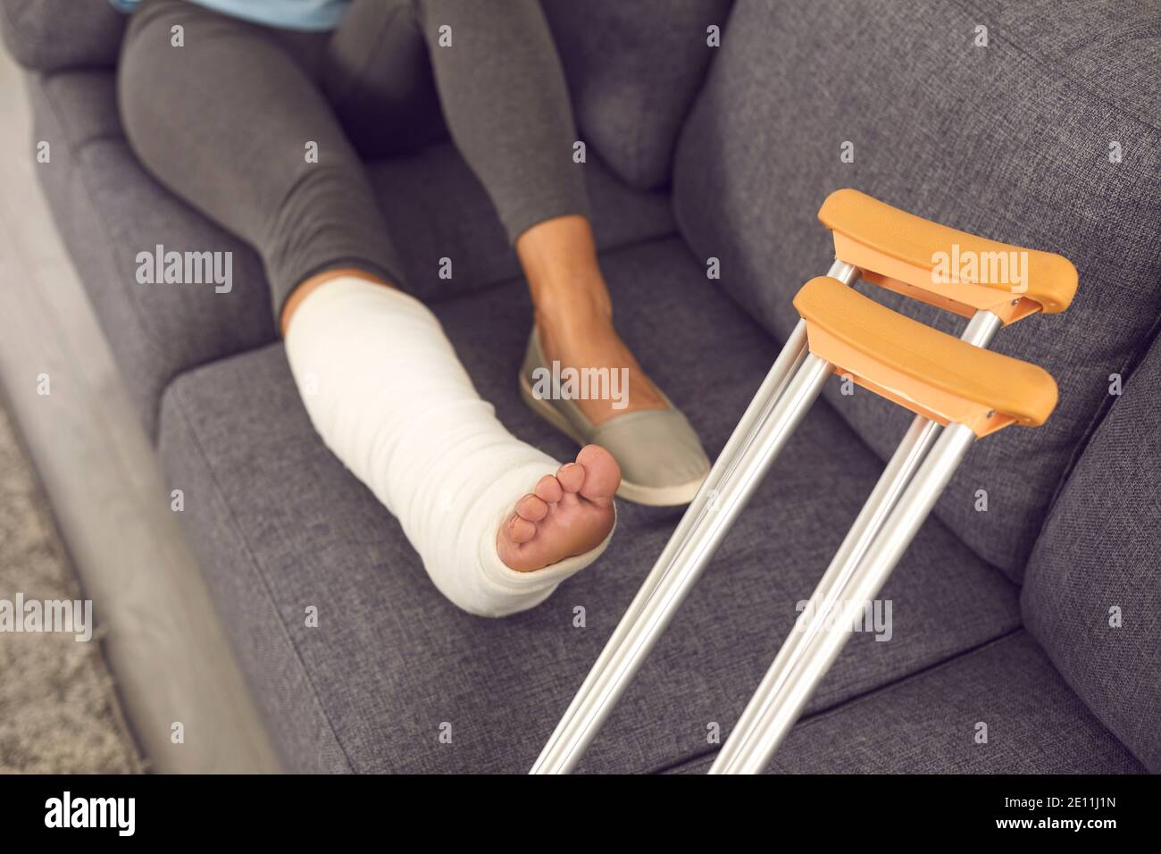 Donna con gamba rotta in gesso calco poggiato su divano durante la riabilitazione a casa Foto Stock