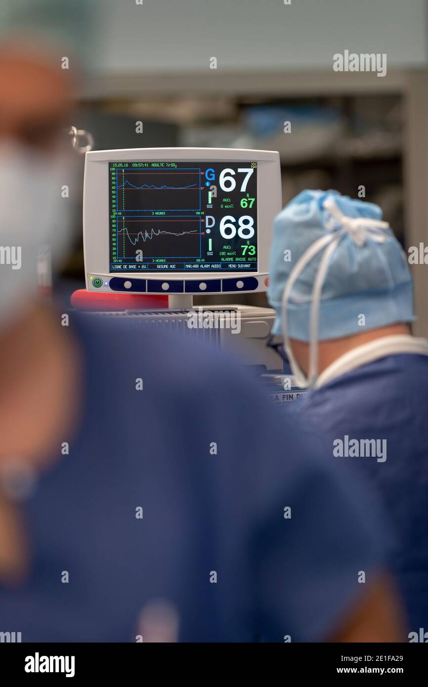 frequenza cardiaca su uno schermo, in sala operatoria Foto Stock