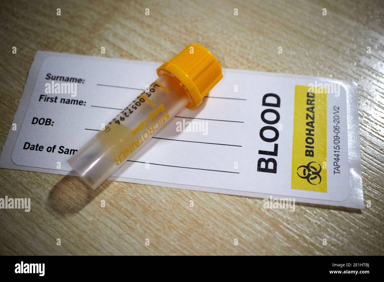 provetta per il prelievo ematico ed etichetta da sangue anticorpale covid-19 commerciale kit di analisi per test domestici per anticorpi del coronavirus ricevuti in il regno unito Foto Stock