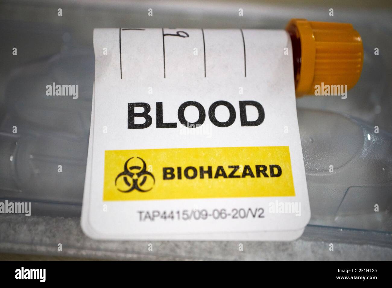 campione di sangue etichettato sangue e rischio biologico per anticorpo covid-19 commerciale kit per analisi del sangue per test domestici per anticorpi del coronavirus ricevuti nel regno unito Foto Stock