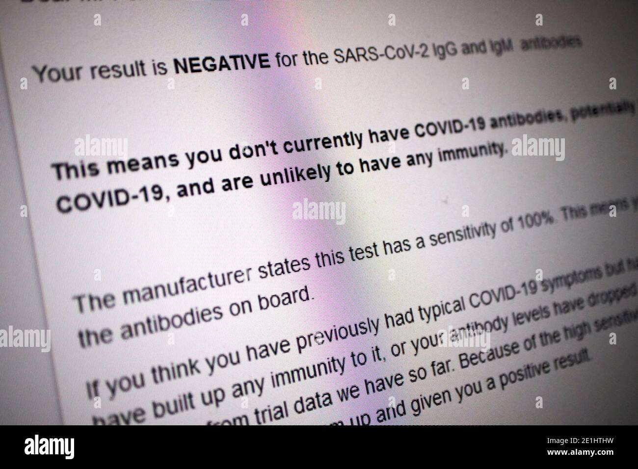 messaggio sullo schermo che fornisce un risultato negativo di un covid-19 analisi del sangue anticorpale per gli anticorpi del coronavirus ricevuti nel regno unito sars-cov-2 Foto Stock