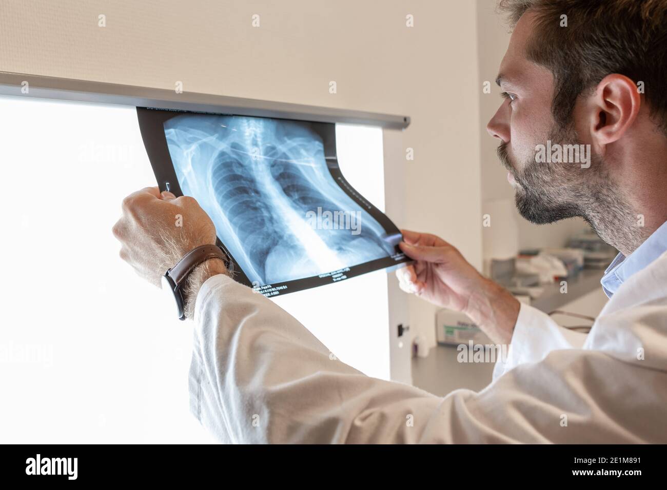medico che esamina una radiografia in ospedale Foto Stock
