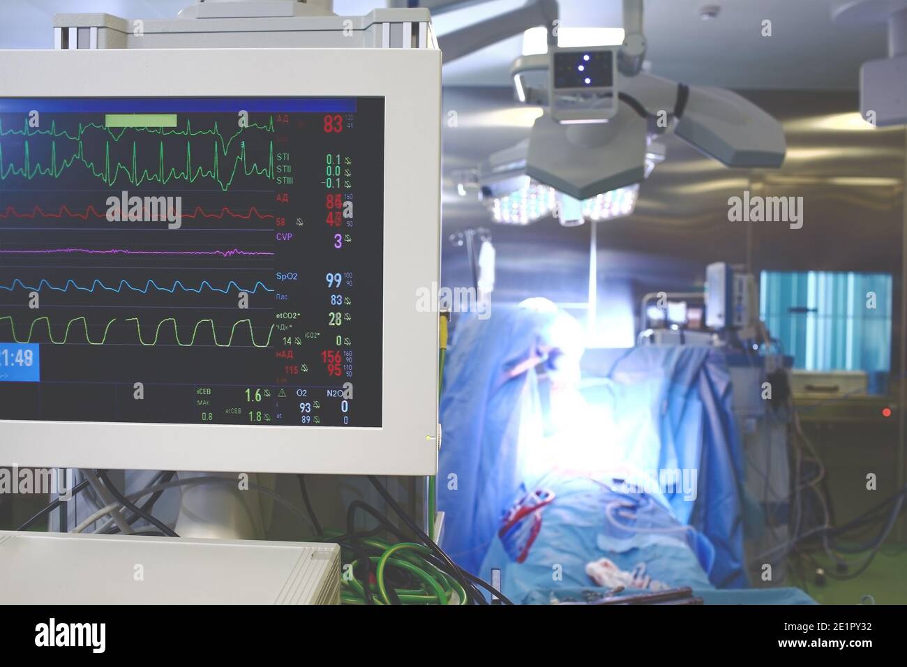 Processo di lavoro in sala operatoria ospedaliera con persone e tecnologia. Foto Stock