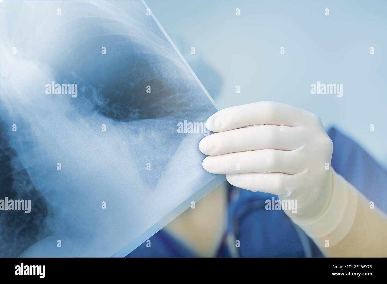Raggi X del paziente in mano di dottori femminili. Foto Stock