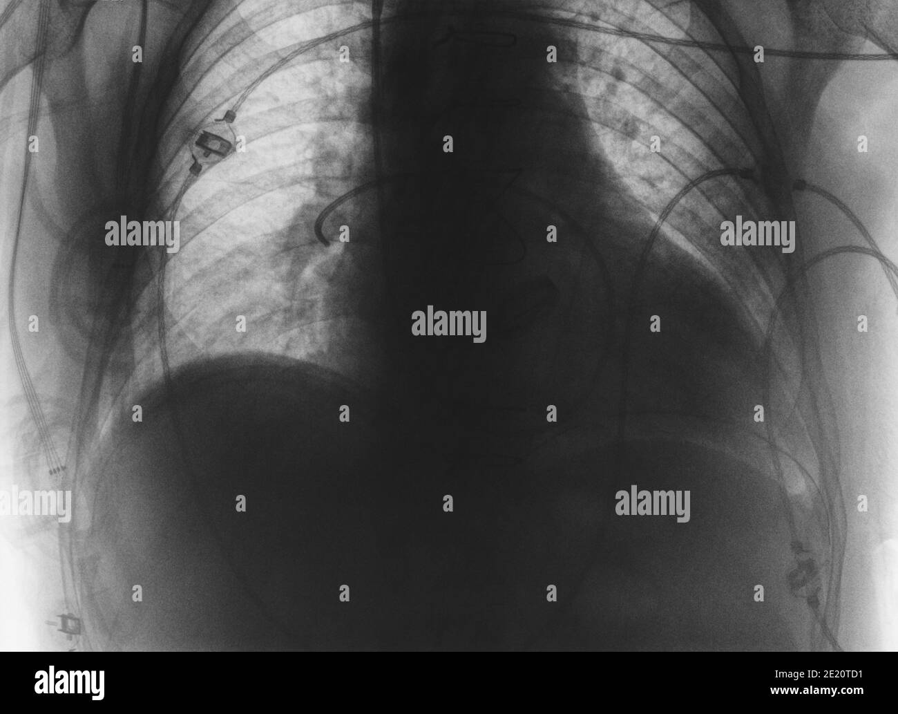 Immagine di un agente medico del paziente. Foto Stock