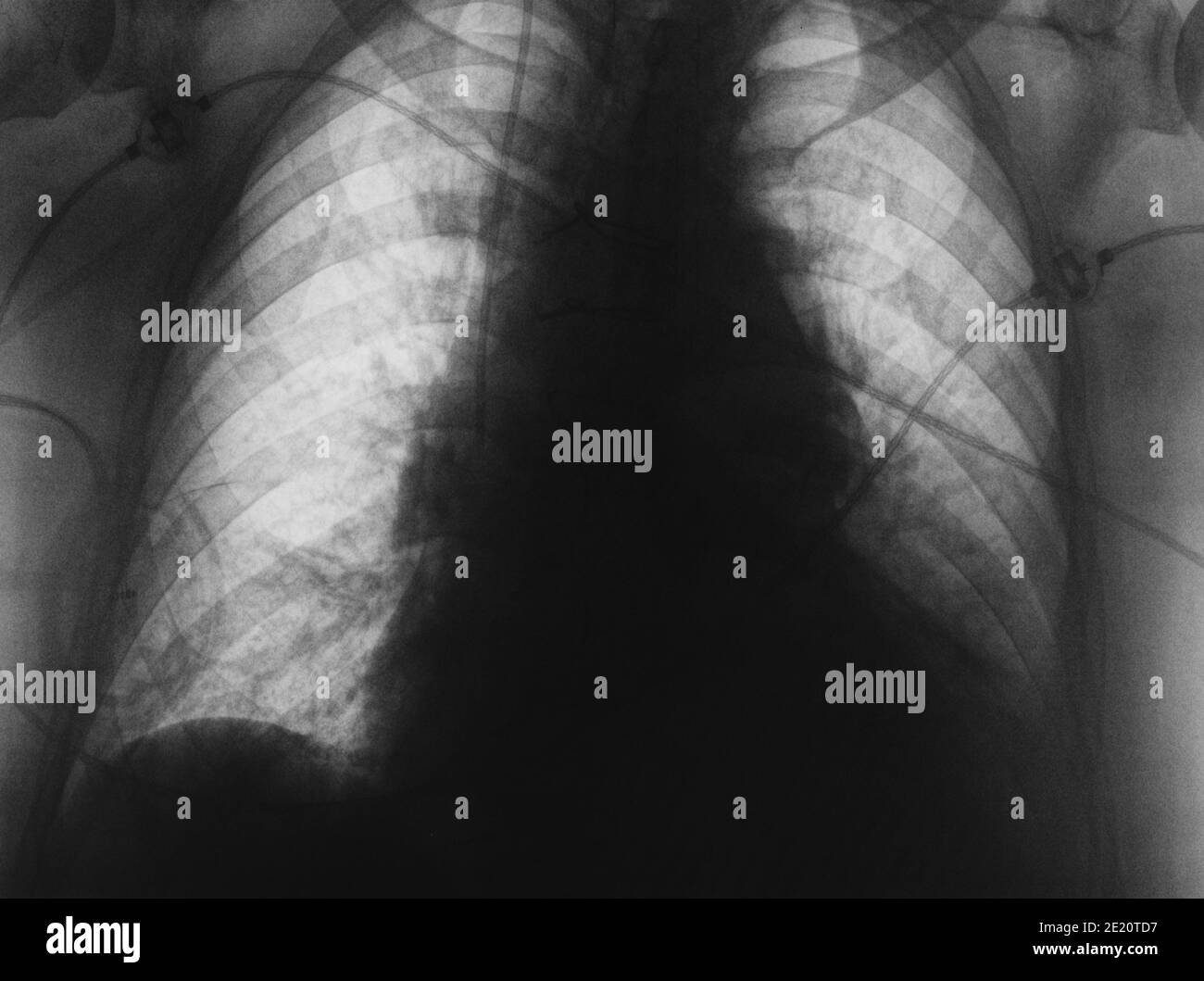 Immagine radiografica come sfondo medico comune. Foto Stock