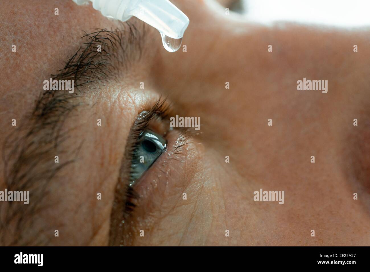 Un uomo mette gli occhi gocce negli occhi prima di mettere su lenti a contatto. Problemi di visione della soluzione. Foto Stock