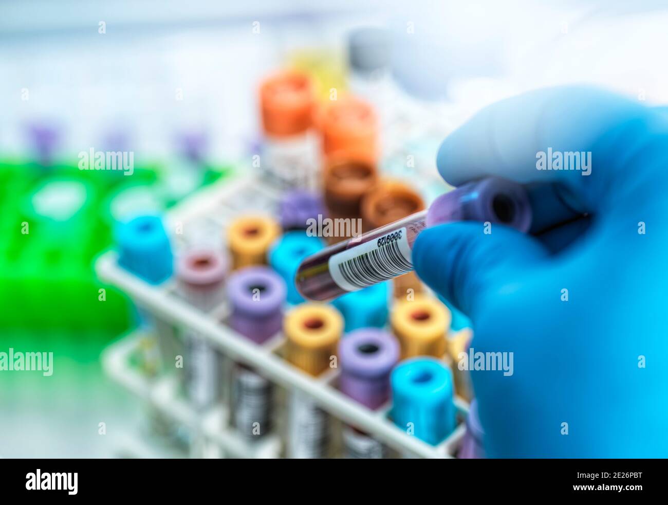 Tecnico medico che prepara campioni umani per le analisi mediche in laboratorio Foto Stock