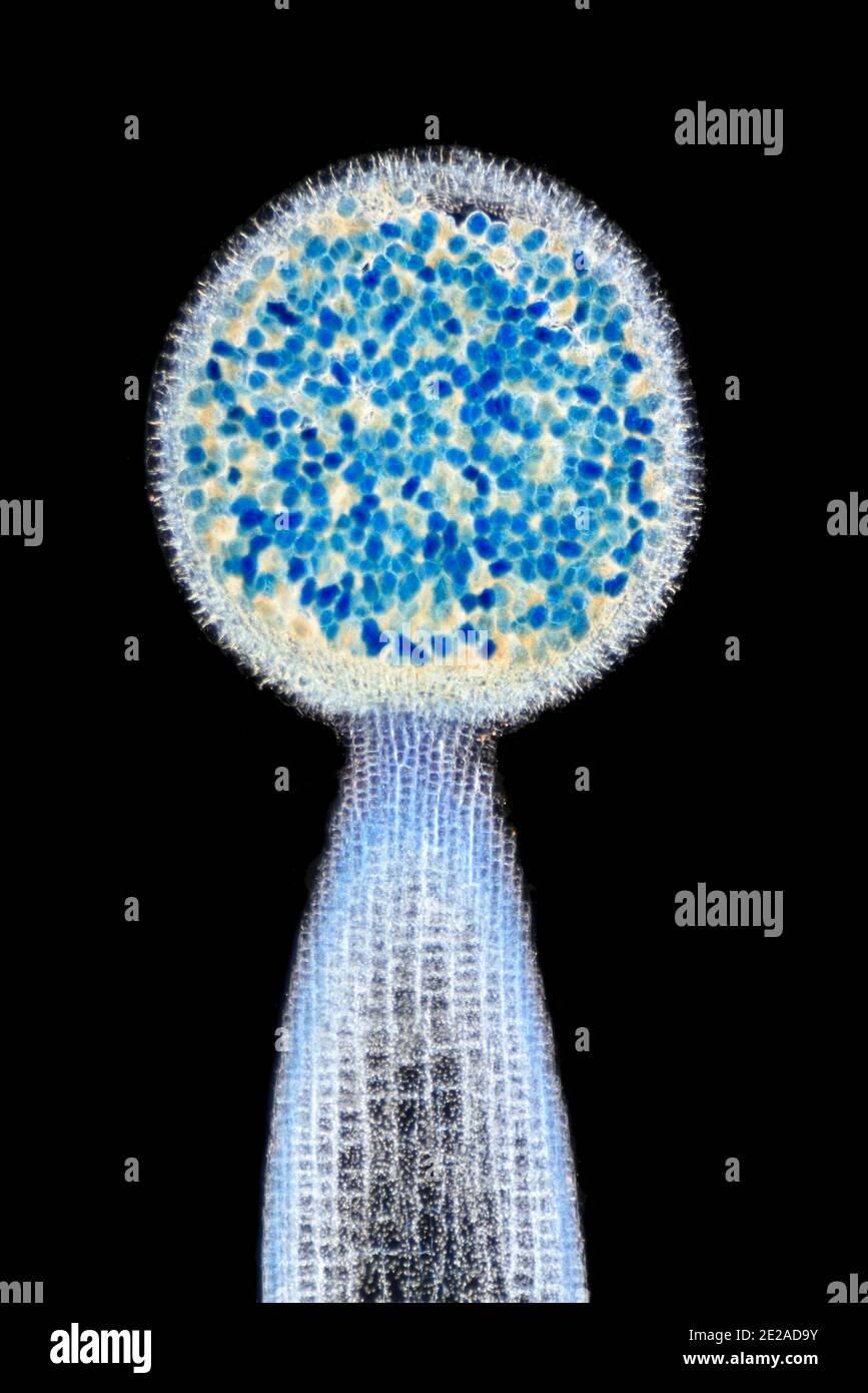 Liverwort pellia LS. Sporogonio, fotomicrografia a campo scuro Foto Stock