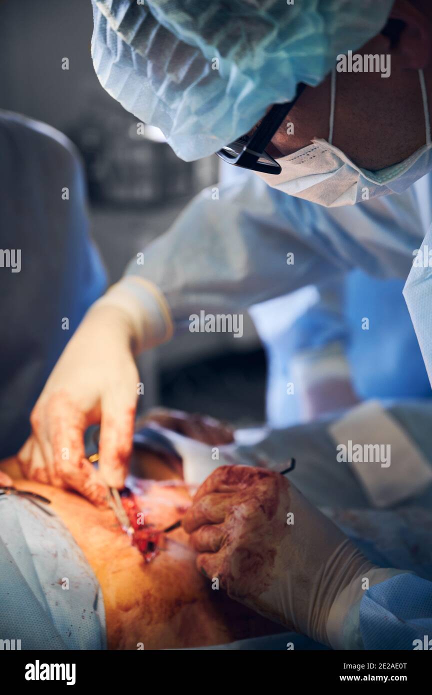 Chirurgo di plastica maschile in guanti sterili che esegue la chirurgia pancia del tuck in sala operatoria. Medico che indossa maschera medica e uniforme chirurgica durante l'esecuzione di chirurgia plastica addominale in clinica. Foto Stock