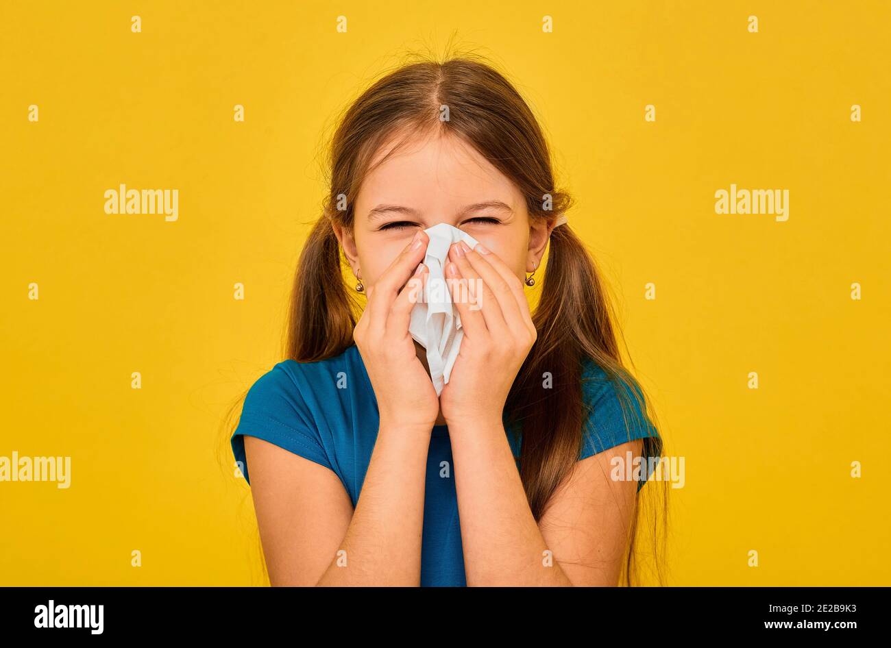 Bambina che soffia il naso nel fazzoletto bianco su sfondo giallo. Il bambino ha un raffreddore e un'influenza Foto Stock