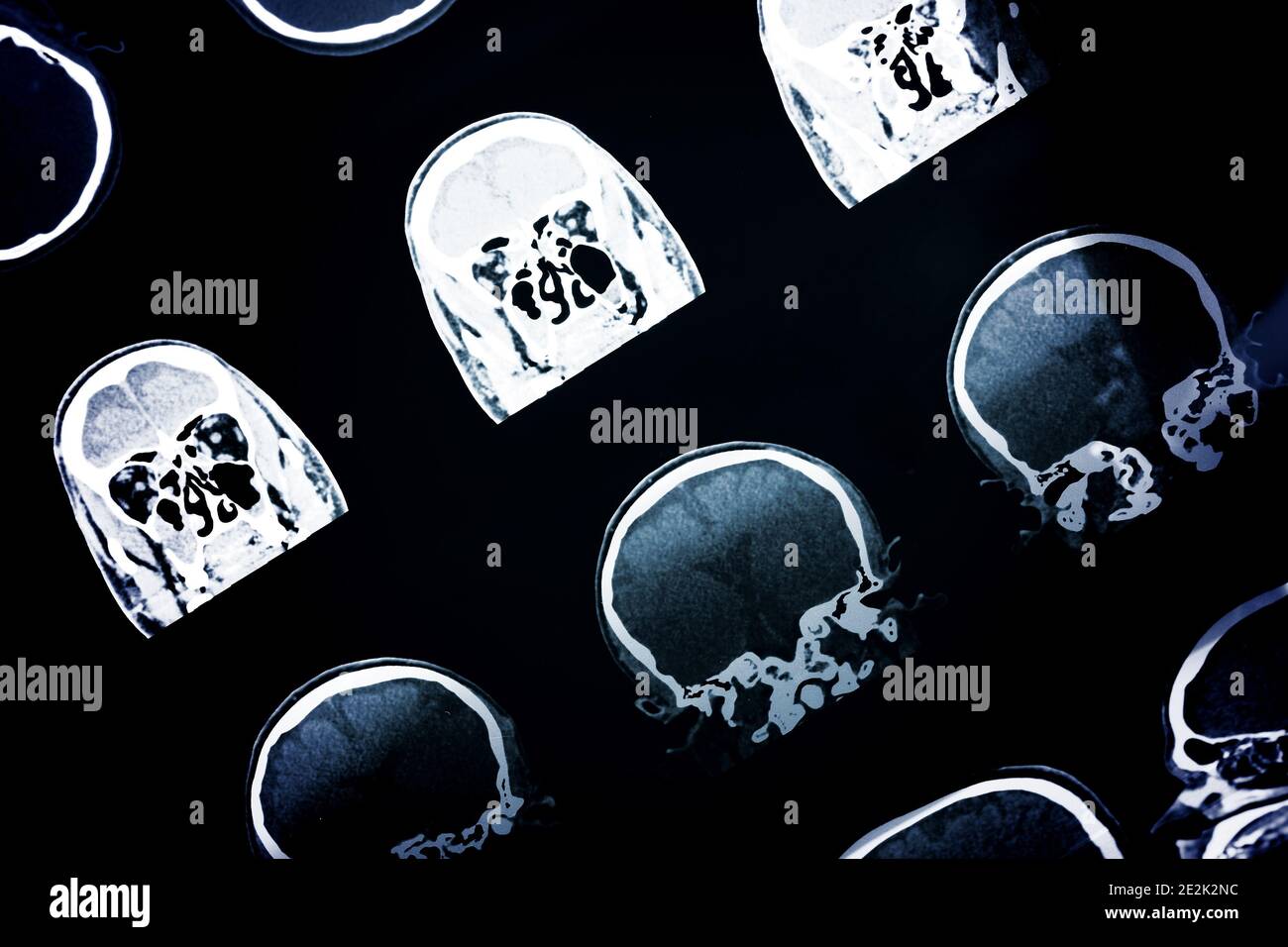 CT-scan della testa umana per un background medico o scientifico Foto Stock