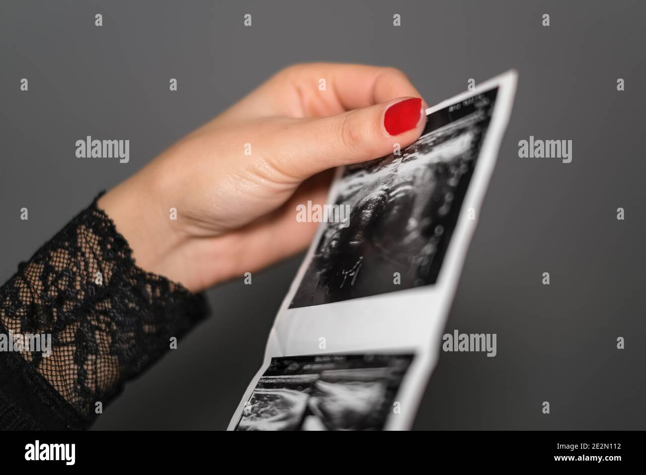 Donna che controlla ecografia risultati esami diagnostici,ansia di gravidanza,assistenza sanitaria Foto Stock