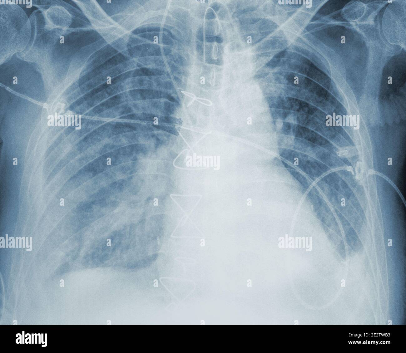 Immagine di un'analisi radiologica. Foto Stock