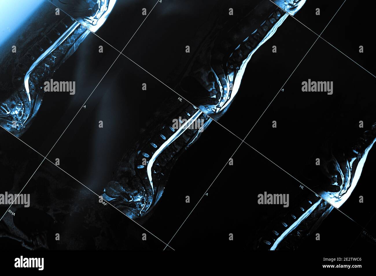 Scansione MRI della vita Foto Stock