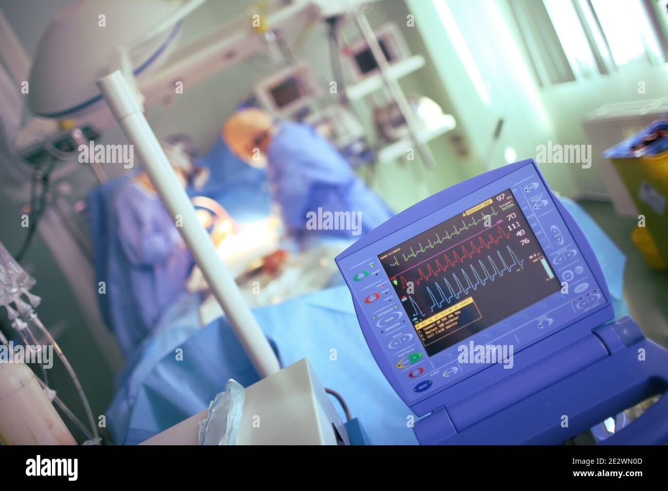 Monitoraggio della funzione cardiaca durante le procedure mediche. Foto Stock
