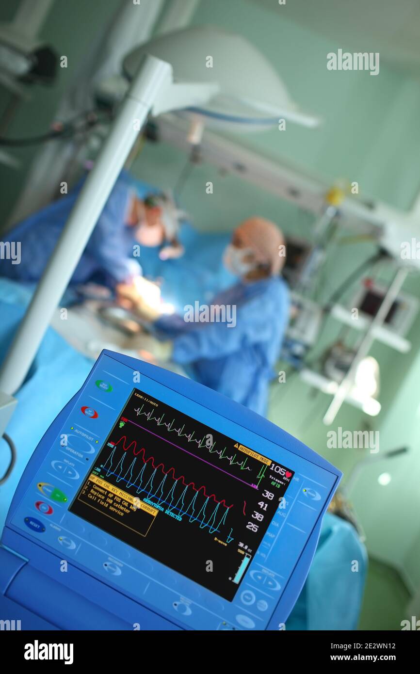 Monitoraggio dell'attività cardiaca del paziente durante le procedure mediche Foto Stock