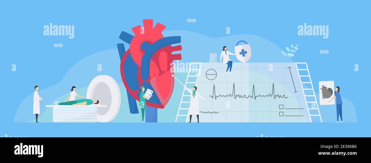 Illustrazione del vettore cardiologico. Questa malattia chiama cardiomiopatia restrittiva. Il cuore è limitato dallo stretching e dal riempimento con il sangue. Muri di lui Illustrazione Vettoriale