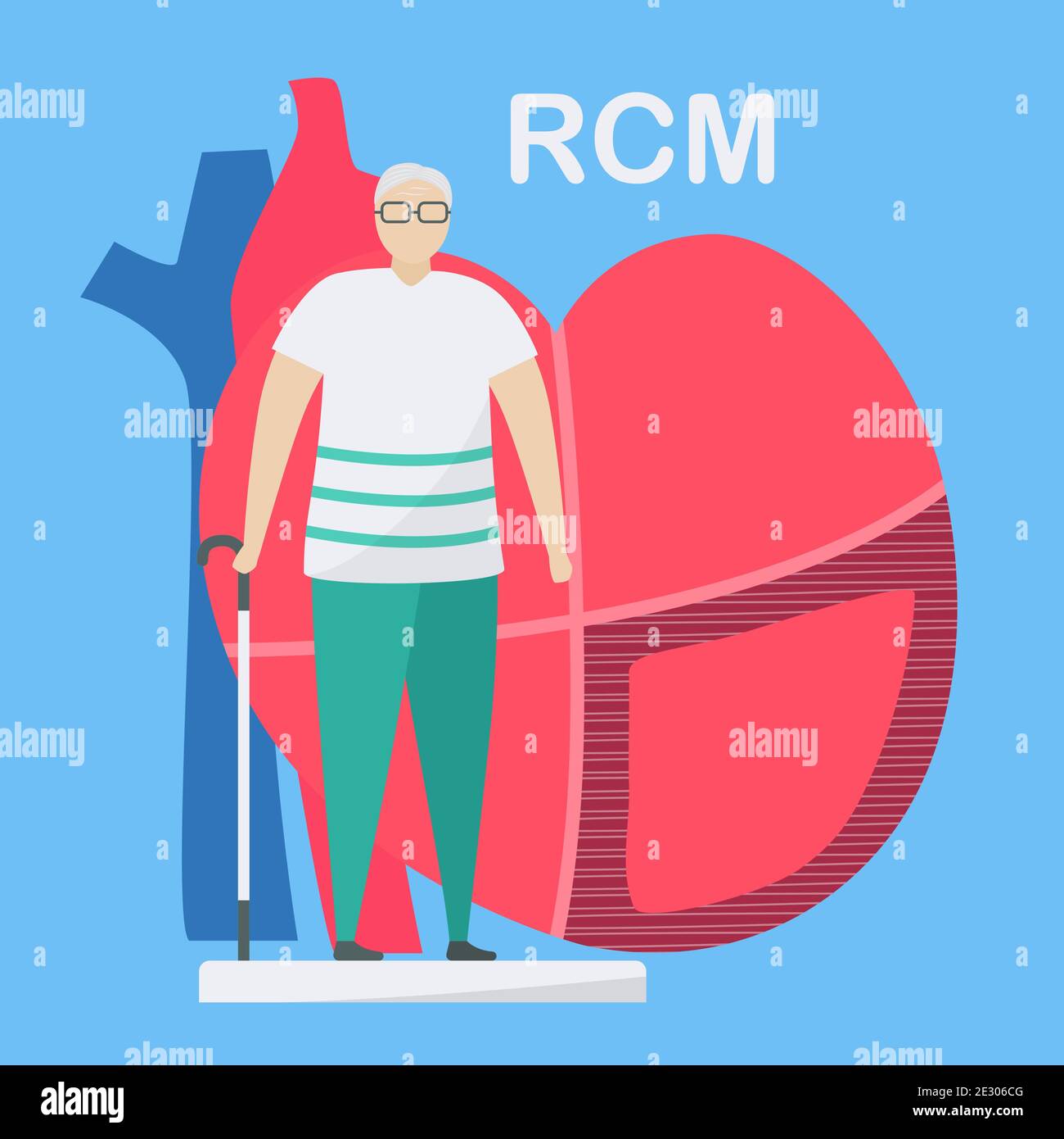 Illustrazione del vettore cardiologico. Questa malattia chiama cardiomiopatia restrittiva. Il cuore è limitato dallo stretching e dal riempimento con il sangue. Muri di lui Illustrazione Vettoriale