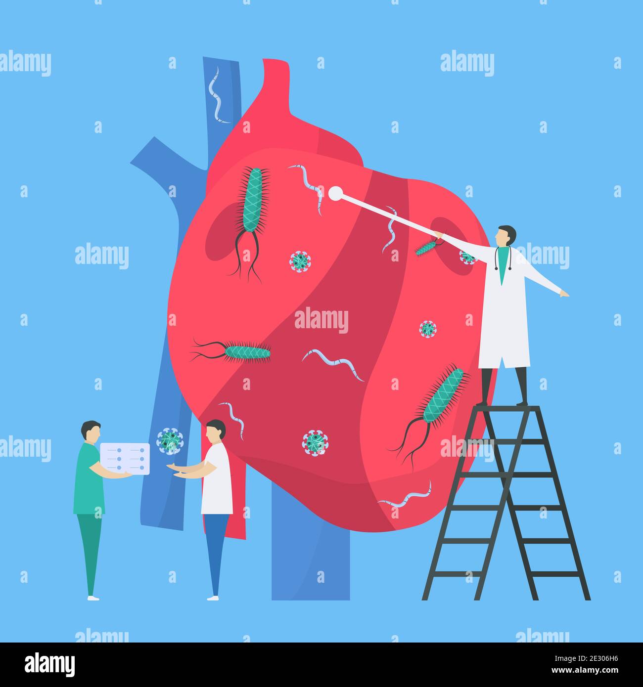 Illustrazione del vettore cardiologico. Questa malattia chiama endocardite. È l'infezione dell'endocardio che è le camere e le valvole del cuore interno. Batteri, par Illustrazione Vettoriale
