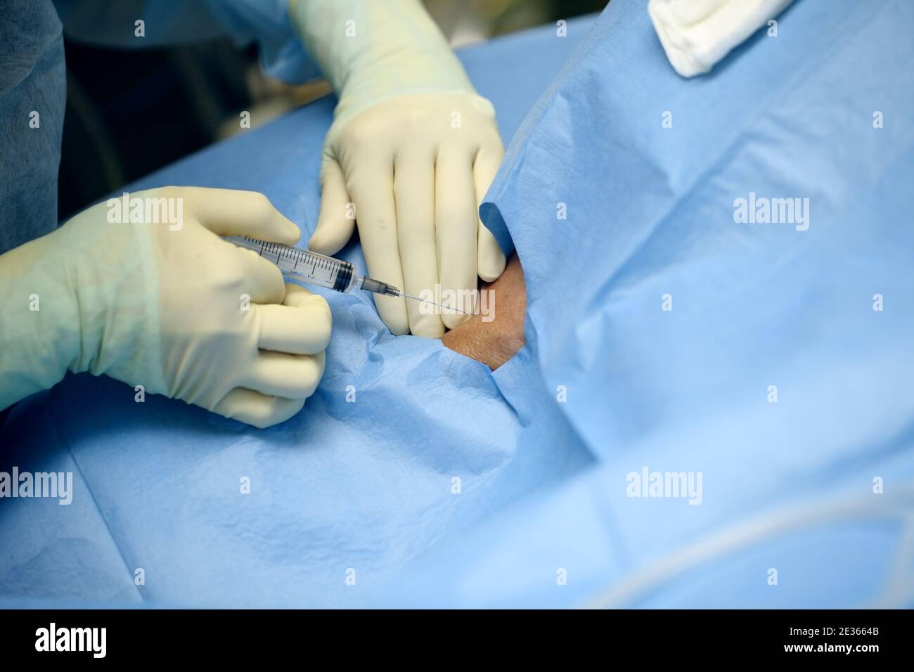 Campionamento del sangue in sala operatoria. Foto Stock