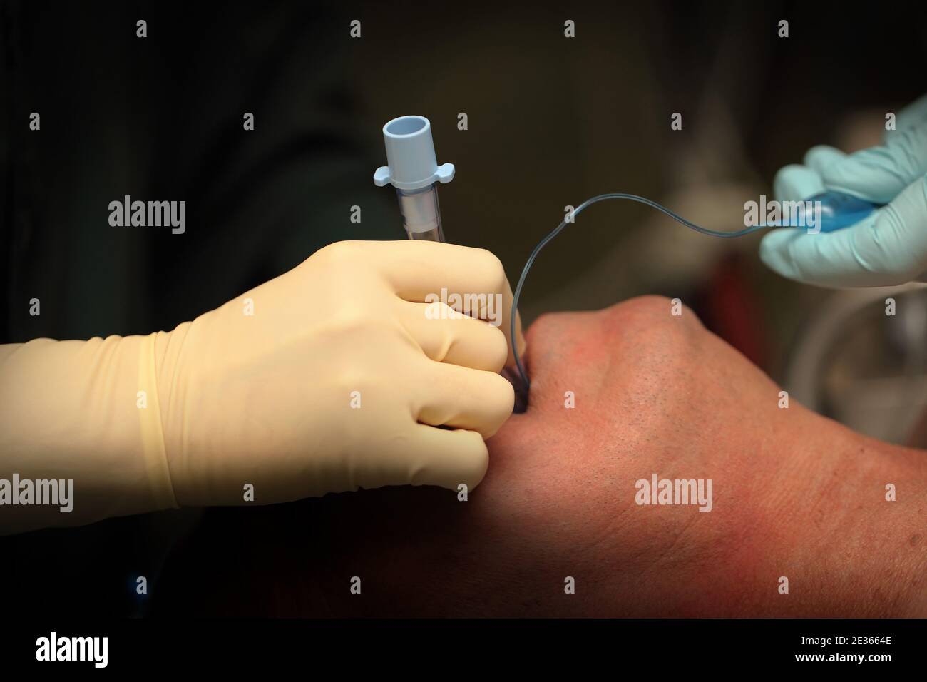 Intubazione della trachea del paziente prima dell'intervento chirurgico. Foto Stock