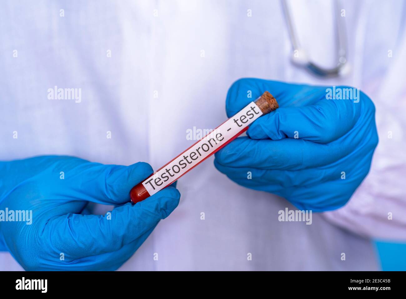 Mani in guanti medici tenere un pallone di sangue per un test di testosterone. Il concetto di ricerca e sviluppo medico. Foto Stock