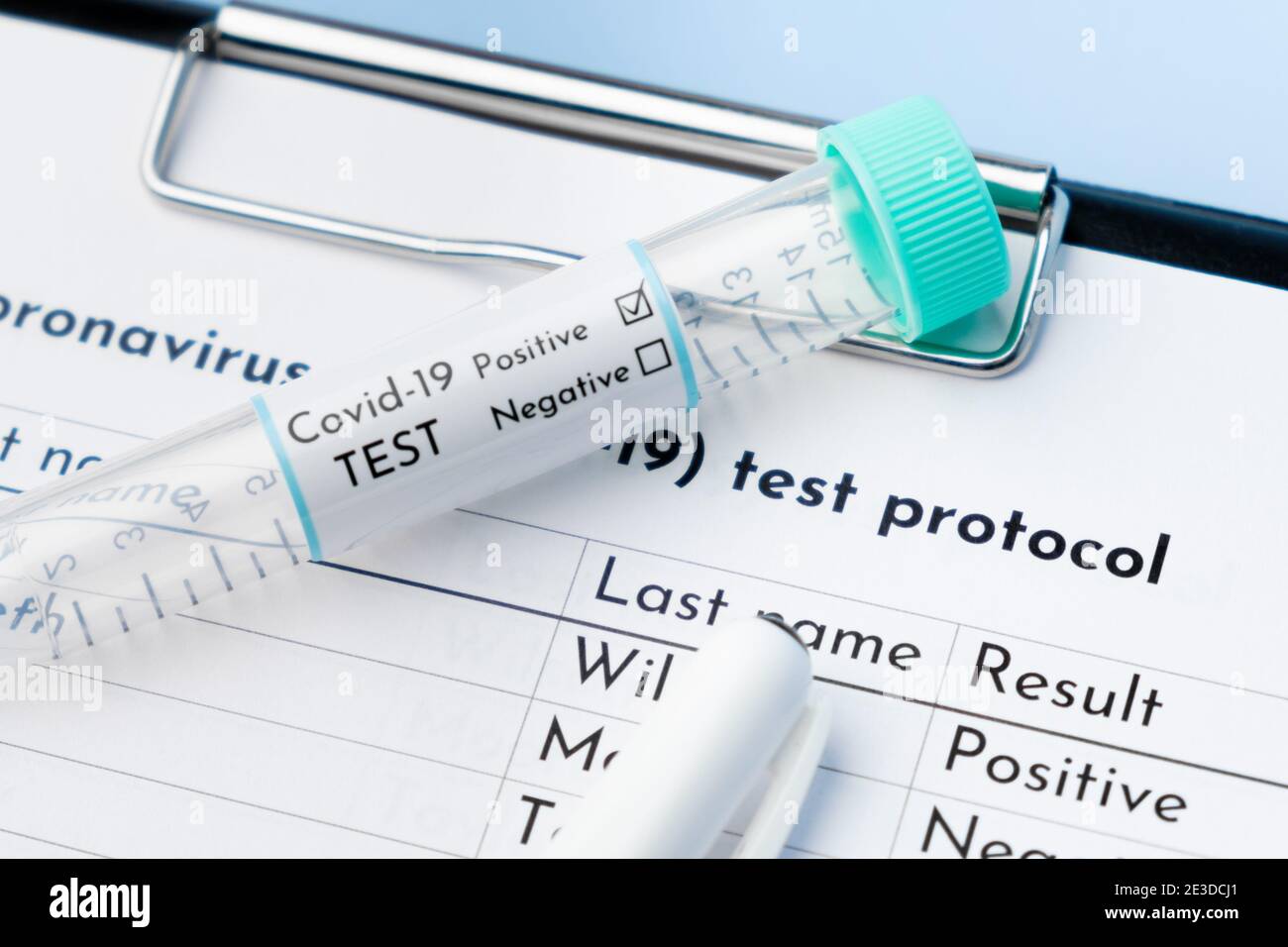 Primo piano provetta per test COVID-19 positiva e protocollo per test medico. Foto Stock
