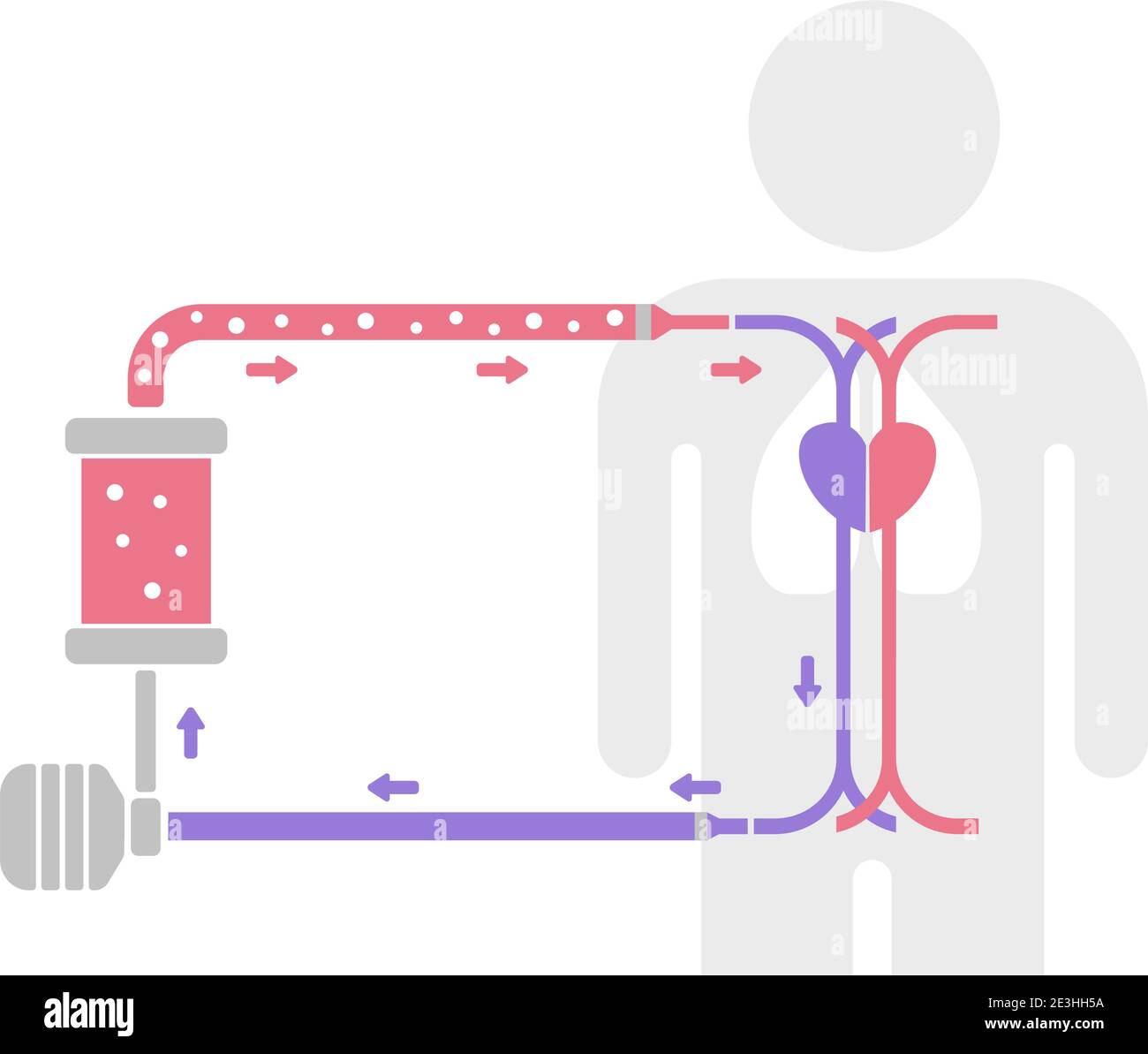 ECMO ( ossigenazione extracorporea della membrana ) illustrazione vettoriale della struttura / nessun testo Illustrazione Vettoriale