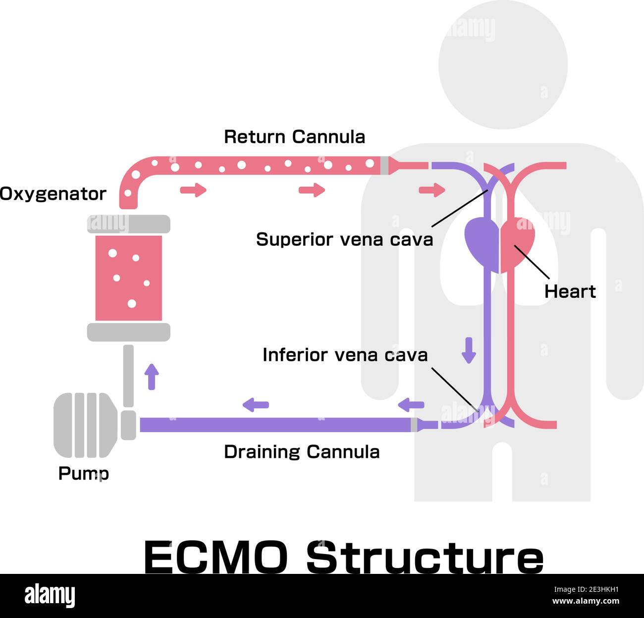 ECMO (Extracorporeal membrane Oxygenation) immagine vettoriale della struttura Illustrazione Vettoriale
