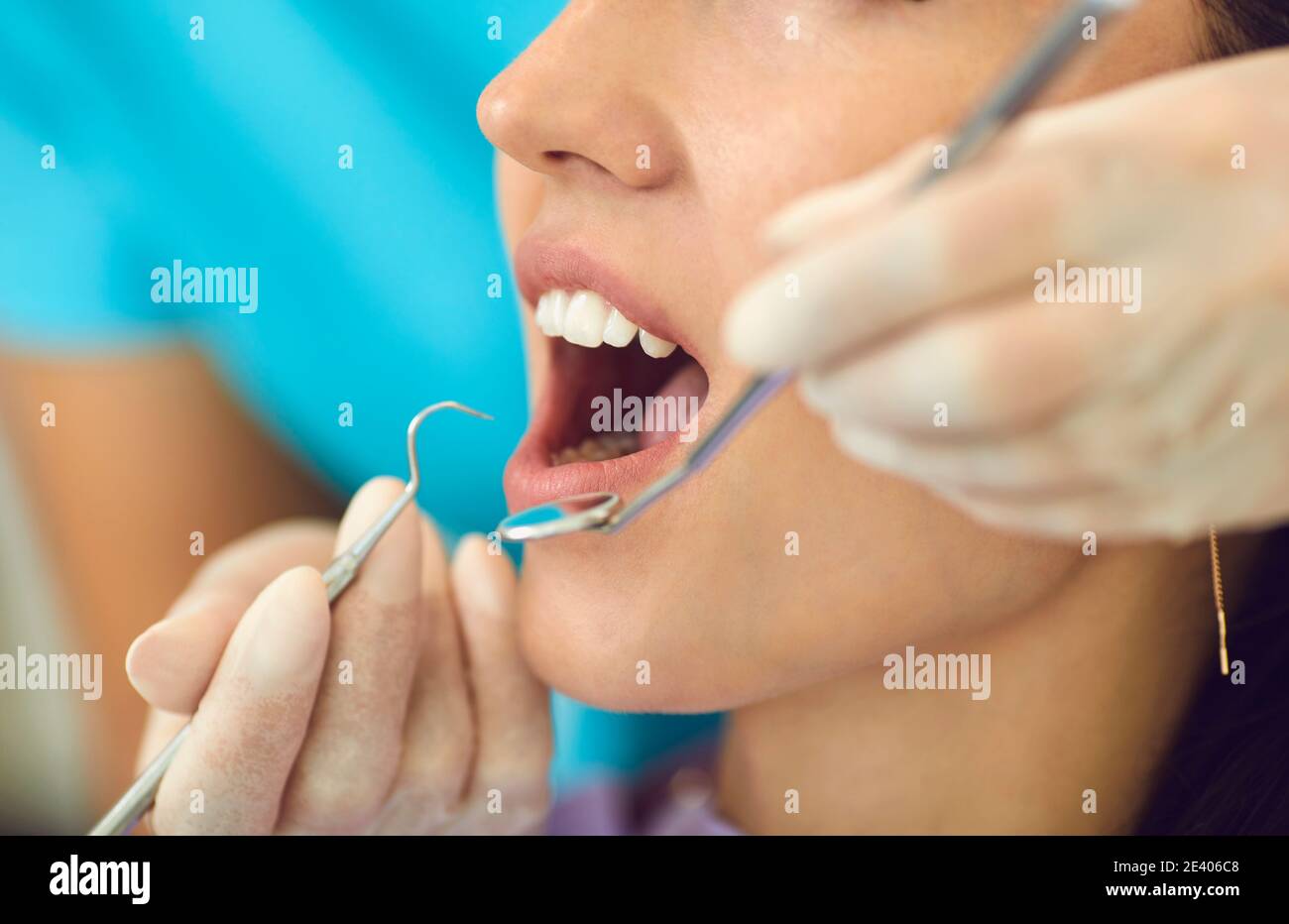 Odontoiatria. Studio dentistico. Cura e trattamento dentale. Denti sani e sorriso. Foto Stock