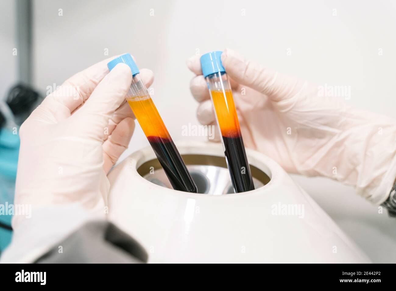 Crop anonimo medico specialista prendendo provette di vetro con plasma sanguigno da una macchina centrifuga mentre si lavora in un laboratorio moderno Foto Stock