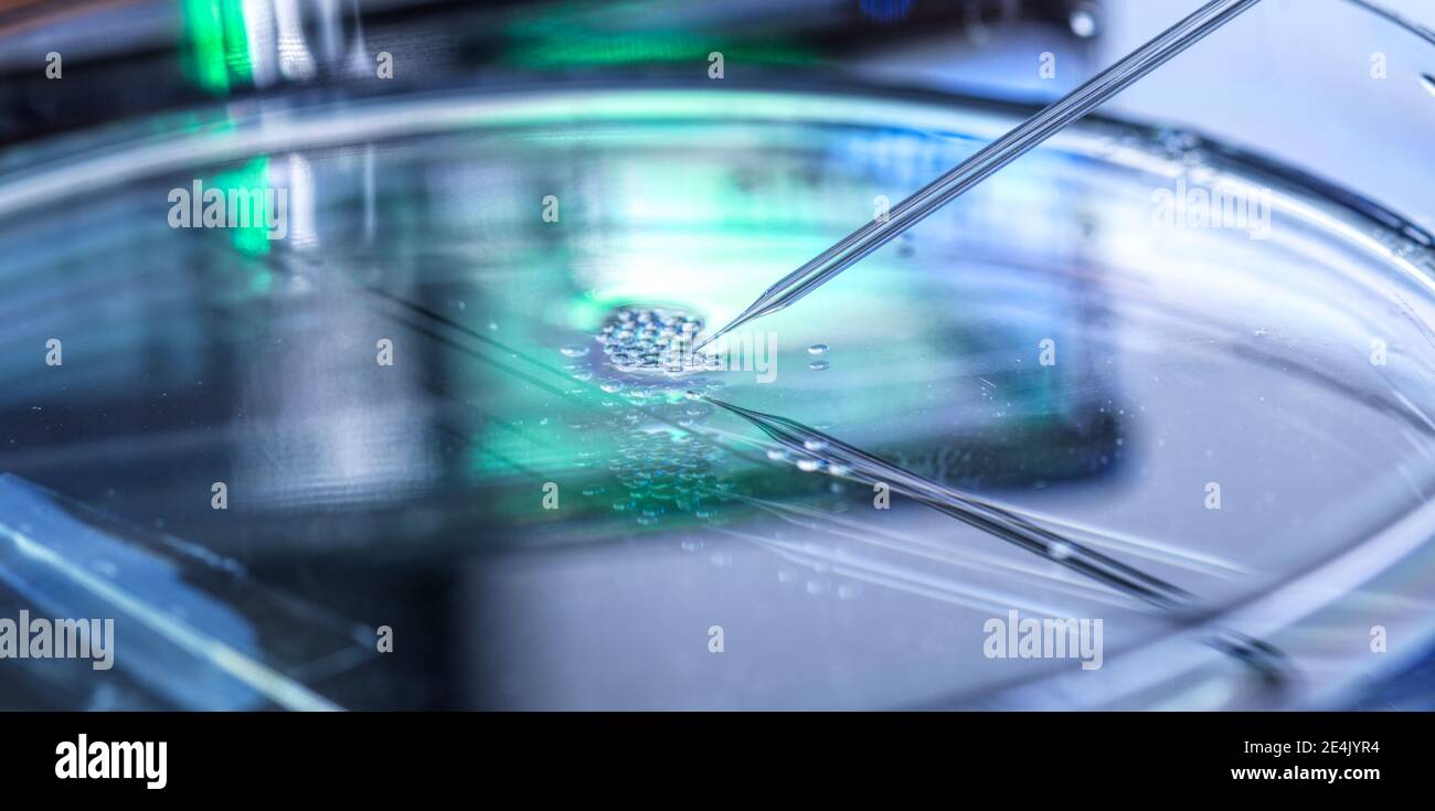 Ricerche scientifiche sul trasferimento nucleare in corso su più cellule staminali embrionali in piastra di petri Foto Stock