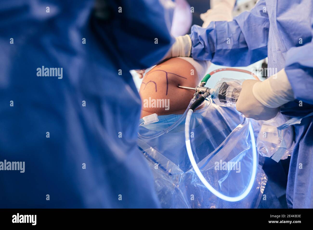 Medici che inseriscono apparecchiature endoscopiche durante il funzionamento in sala operatoria Foto Stock
